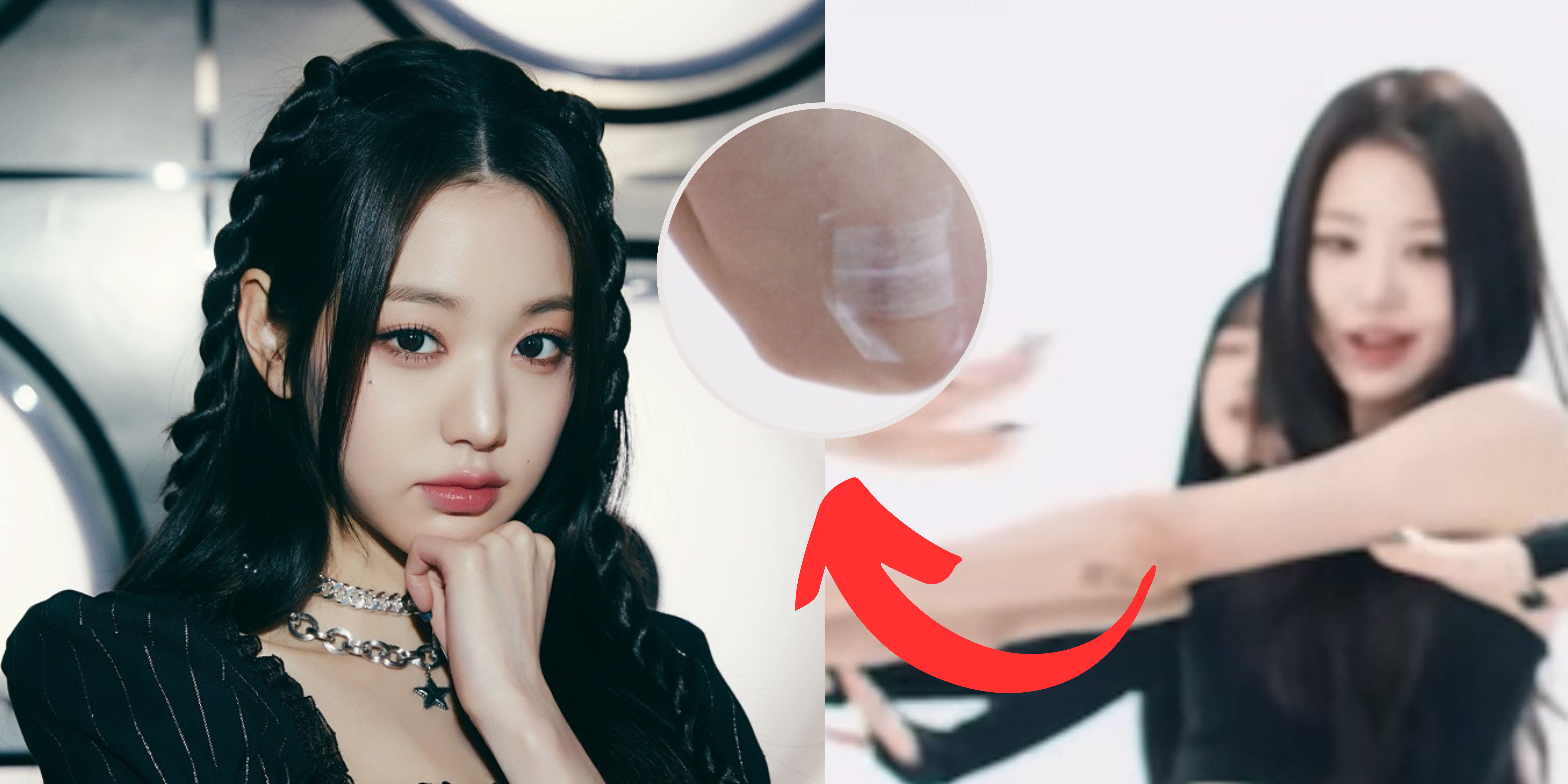 Jang Wonyoung's undisclosed arm injury resurfaces in old photos, igniting netizens' worries