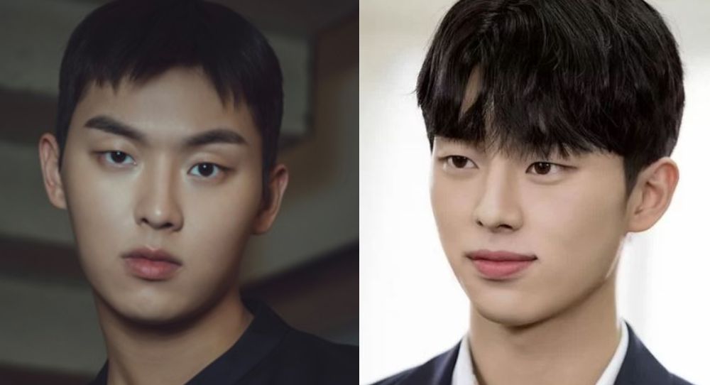 Actor Choi Hyun Wook's Transformative Journey with Braces — Netizens Weigh In Where He Looks Better Before or After