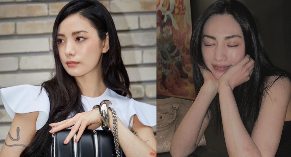 Nana's Latest Photos Show Significant Progress in Tattoo Removal Journey