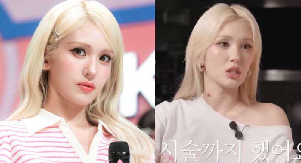 Jeon Somi Reveals Struggles with Hair Loss: "I Had Bald Spots and Needed Hair Extensions"