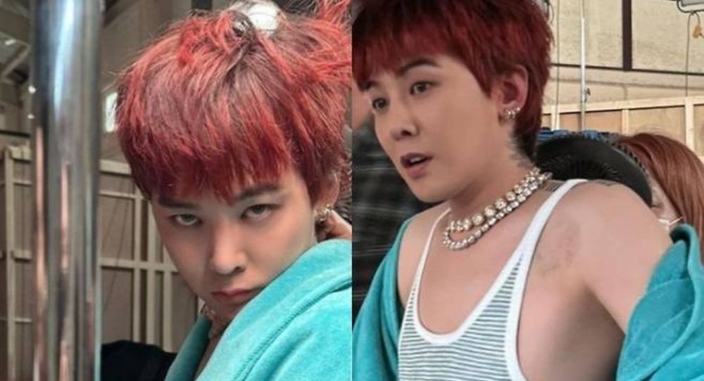 G-Dragon’s Cupping Marks Spark Attention During Comeback Promotions