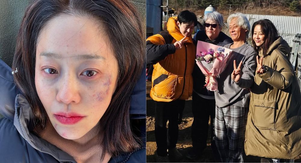 Go Hyun Jung Shocks Fans With Bruised Face After Finishing "The Mantis: Original Sin" Filming: "I just want to sleep"